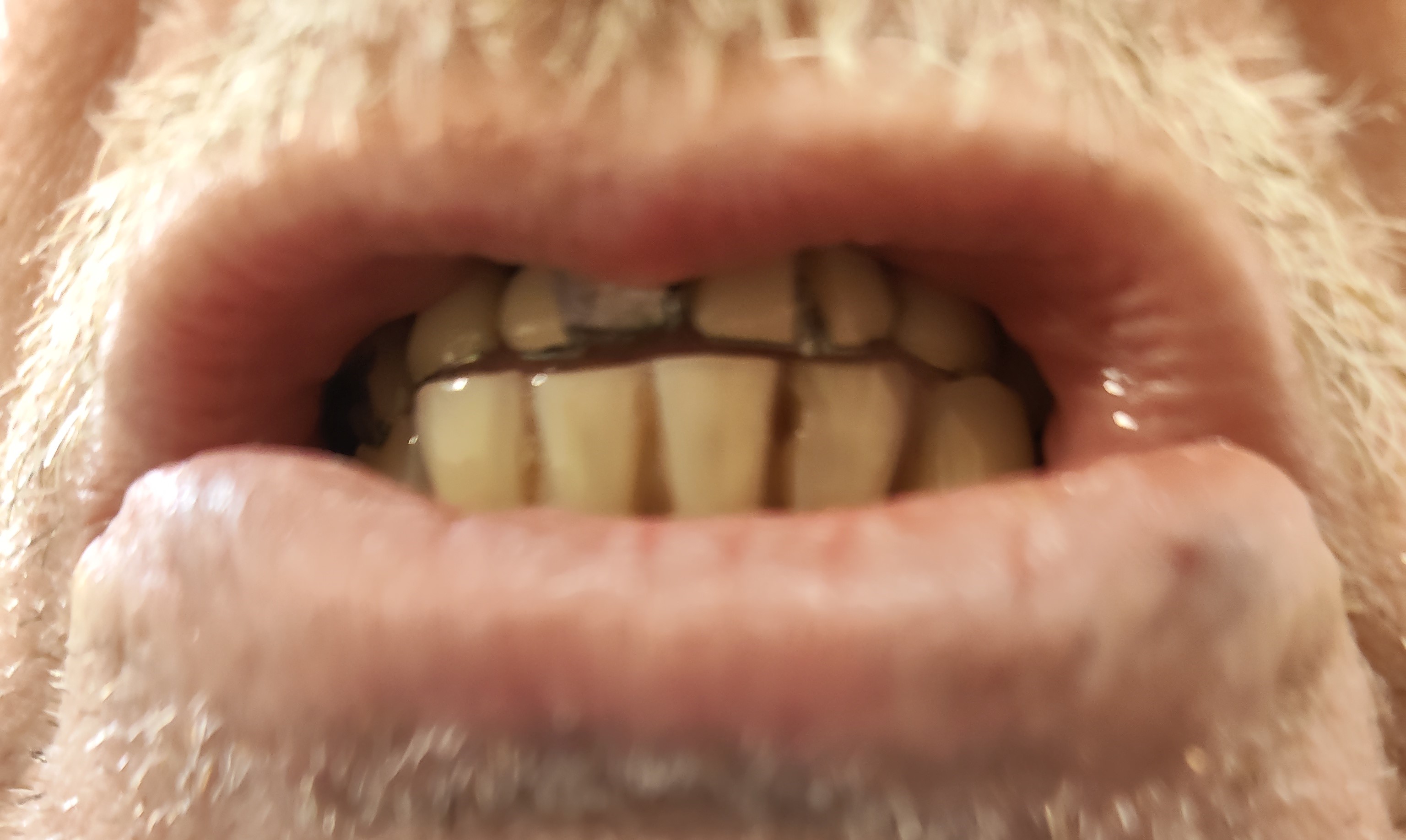 Przed leczeniem